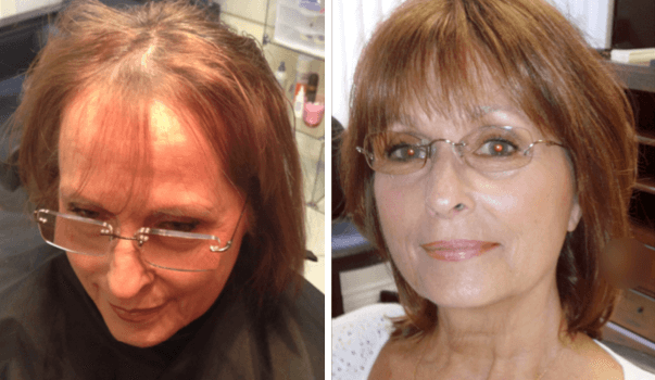 women-before-after-1